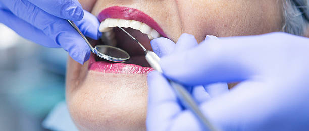 Best Emergency Dental Care for Broken or Chipped Teeth in Trumbull Center, CT